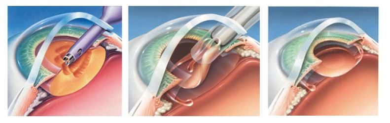 Dr LADJIMI Rachid, ophtalmologue