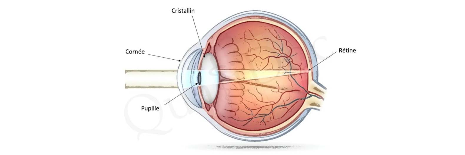 Chirurgie réfractive