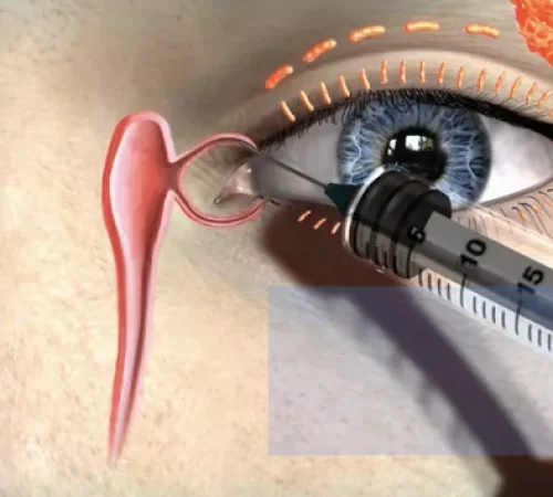 DR LADJIMI Rachid, Ophtalmologue